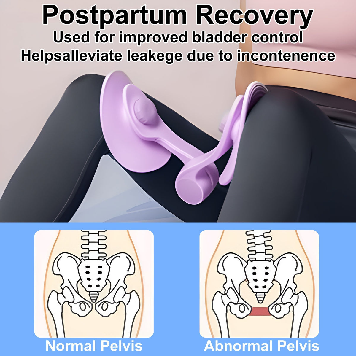 💖LBMLBM™-Improving bladder control can help alleviate urine leakage caused by incontinence🔥
